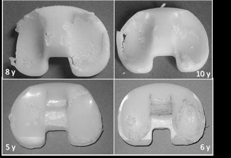  Ultra-High Molecular Weight Polyethylene: Bir Devrim Niteliğinde Malzeme mi Yoksa Geleceğin Gizemi mi?